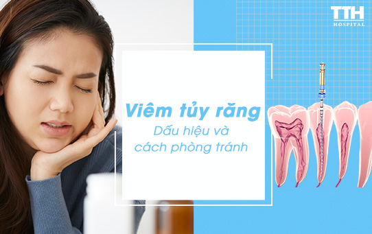 Viêm tủy răng - Dấu hiệu và cách phòng ngừa
